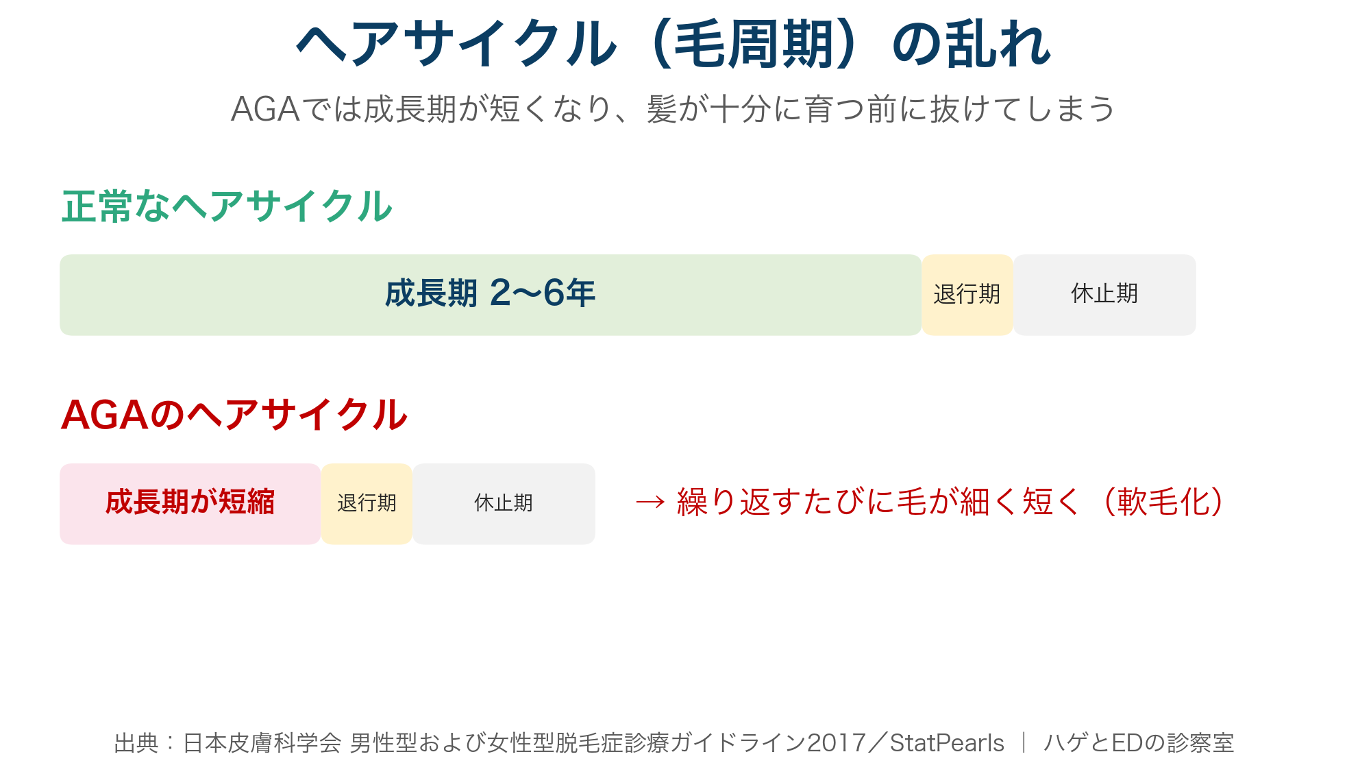 AGAによるヘアサイクルの乱れと成長期短縮の図解
